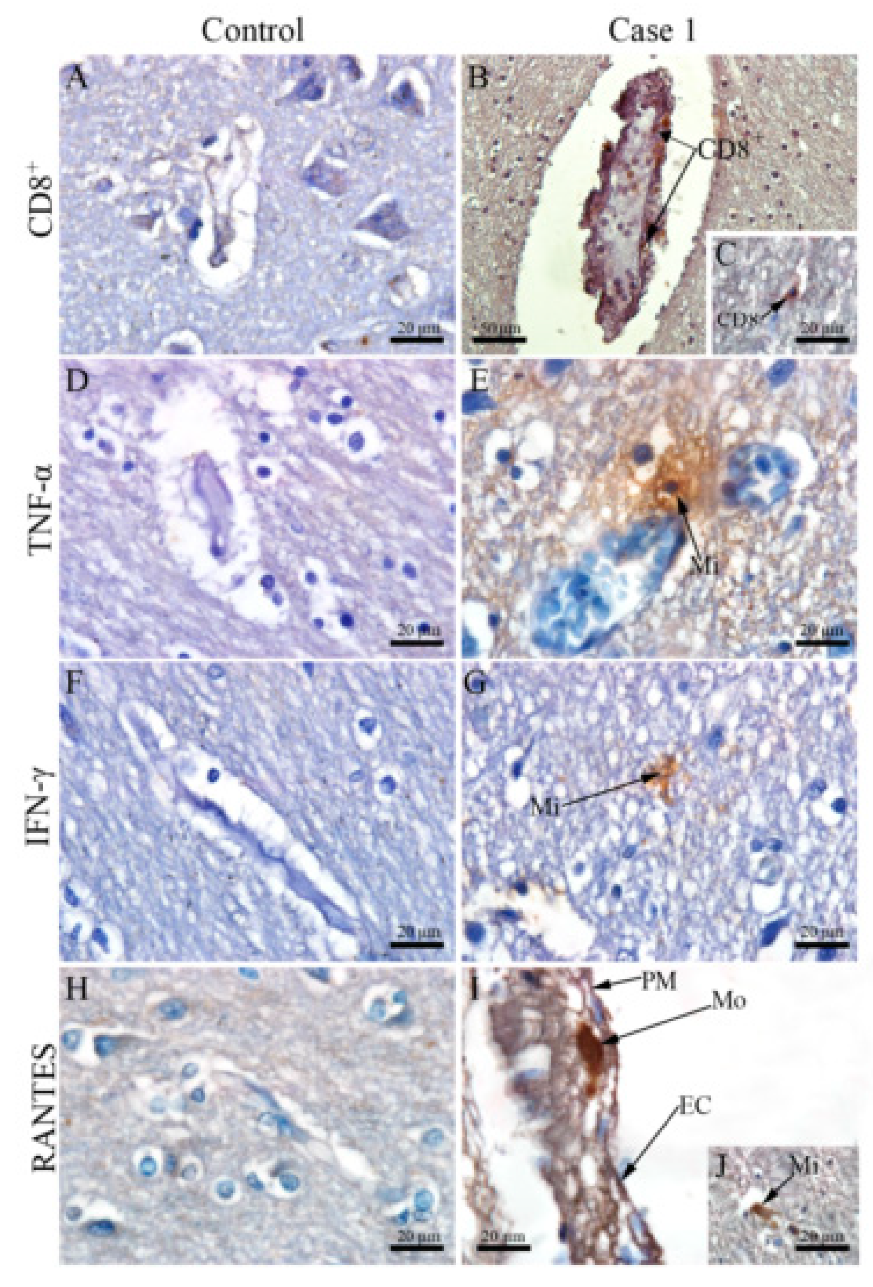 Viruses 12 00603 g005