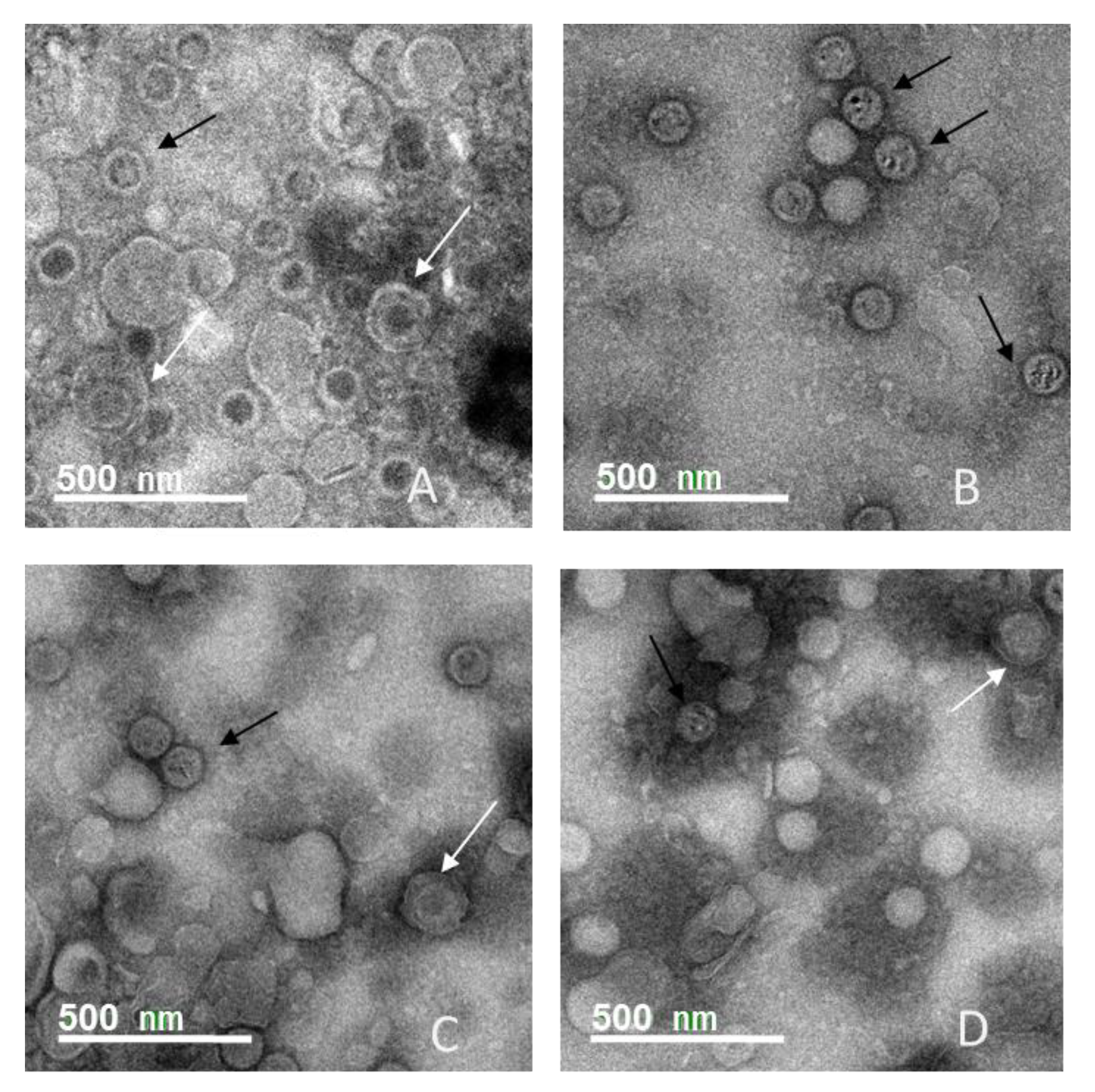 Viruses 13 00322 g005 Viruses 13 00322 g005