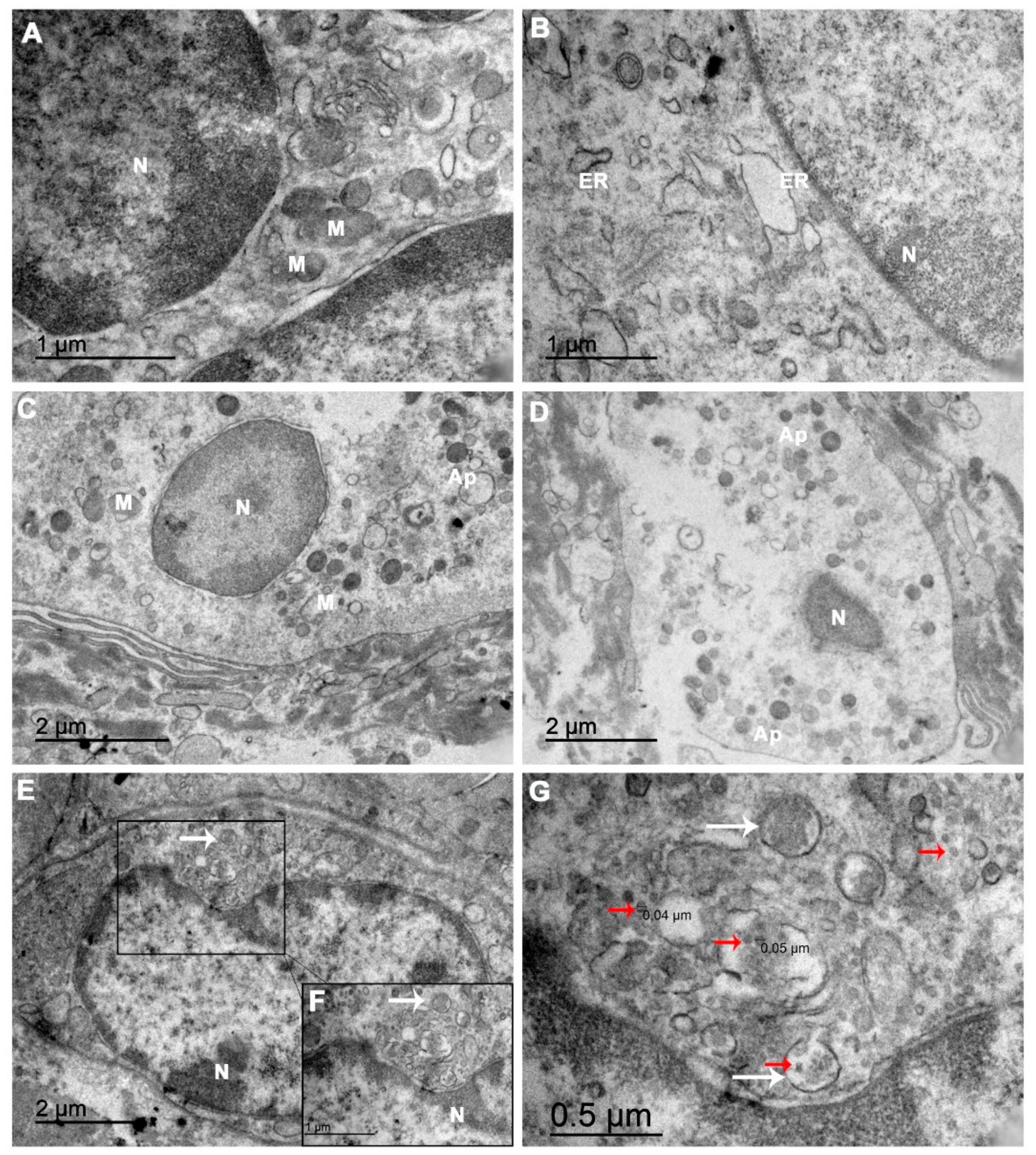 Viruses 13 00554 g004 Viruses 13 00554 g004