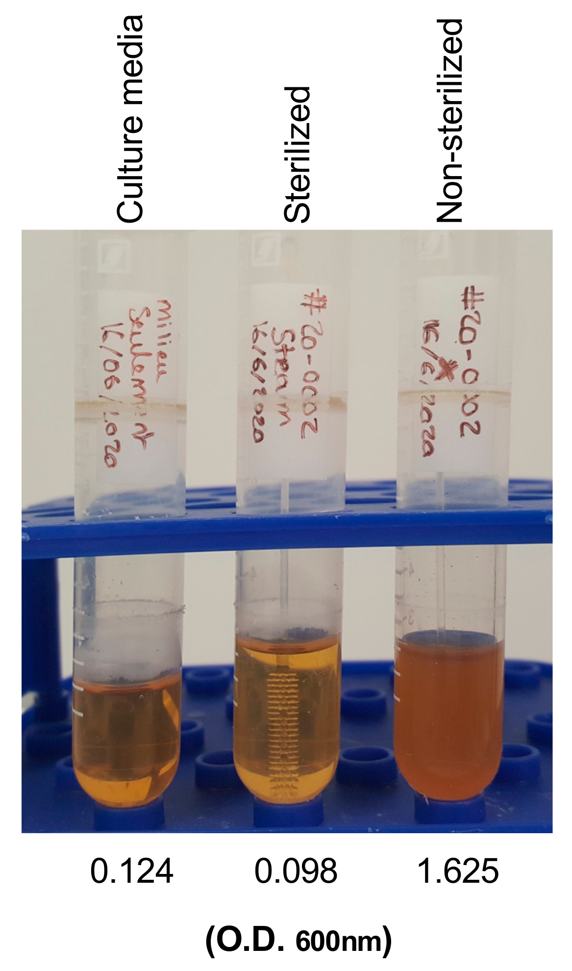 Coronavirus: 3D printing companies answer the call for swabs for Covid-19  tests