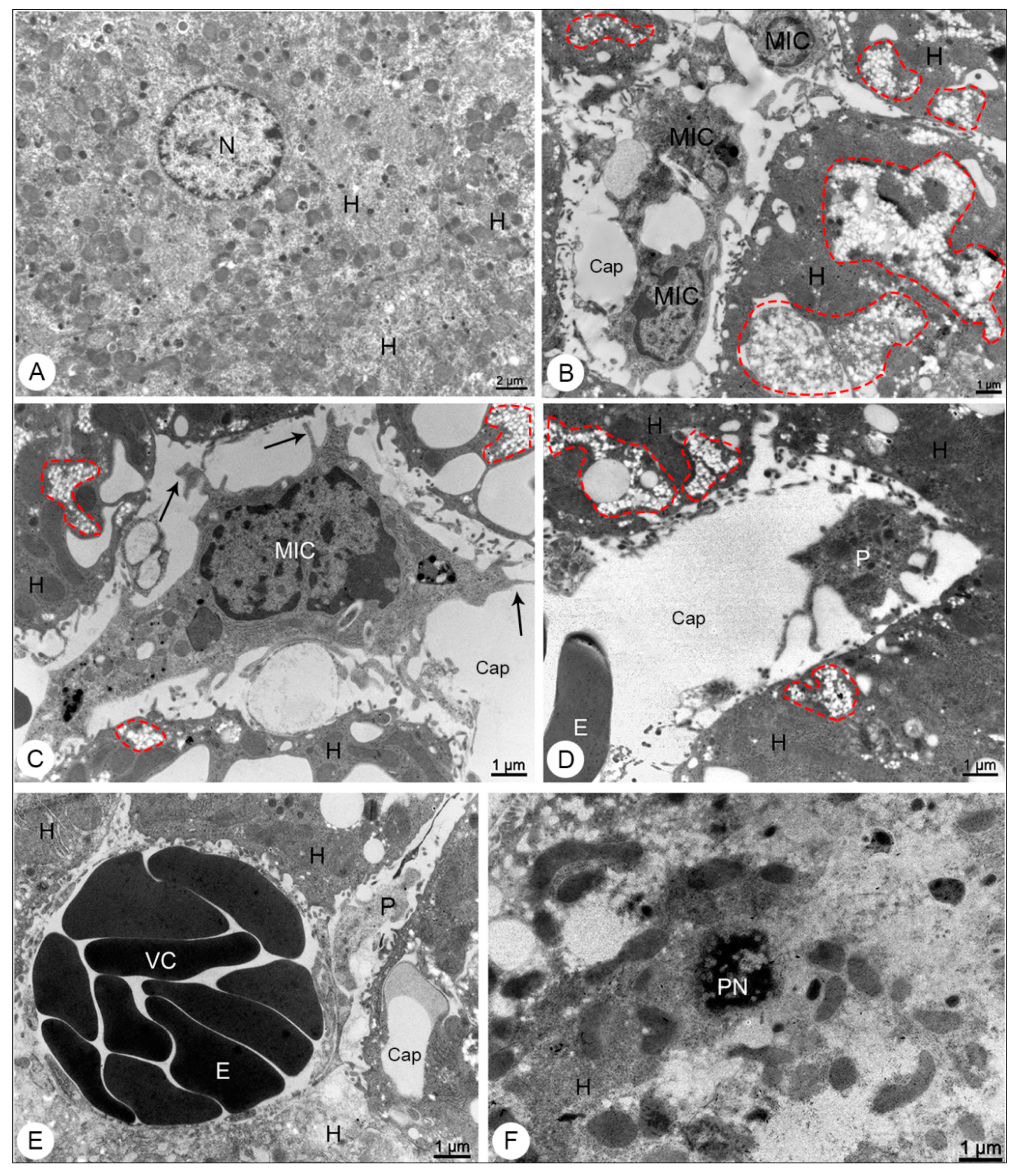 Viruses | Free Full-Text | Morphological Aspects and Viremia Analysis of  BALB/c Murine Model Experimentally Infected with Dengue Virus Serotype 4 |  HTML
