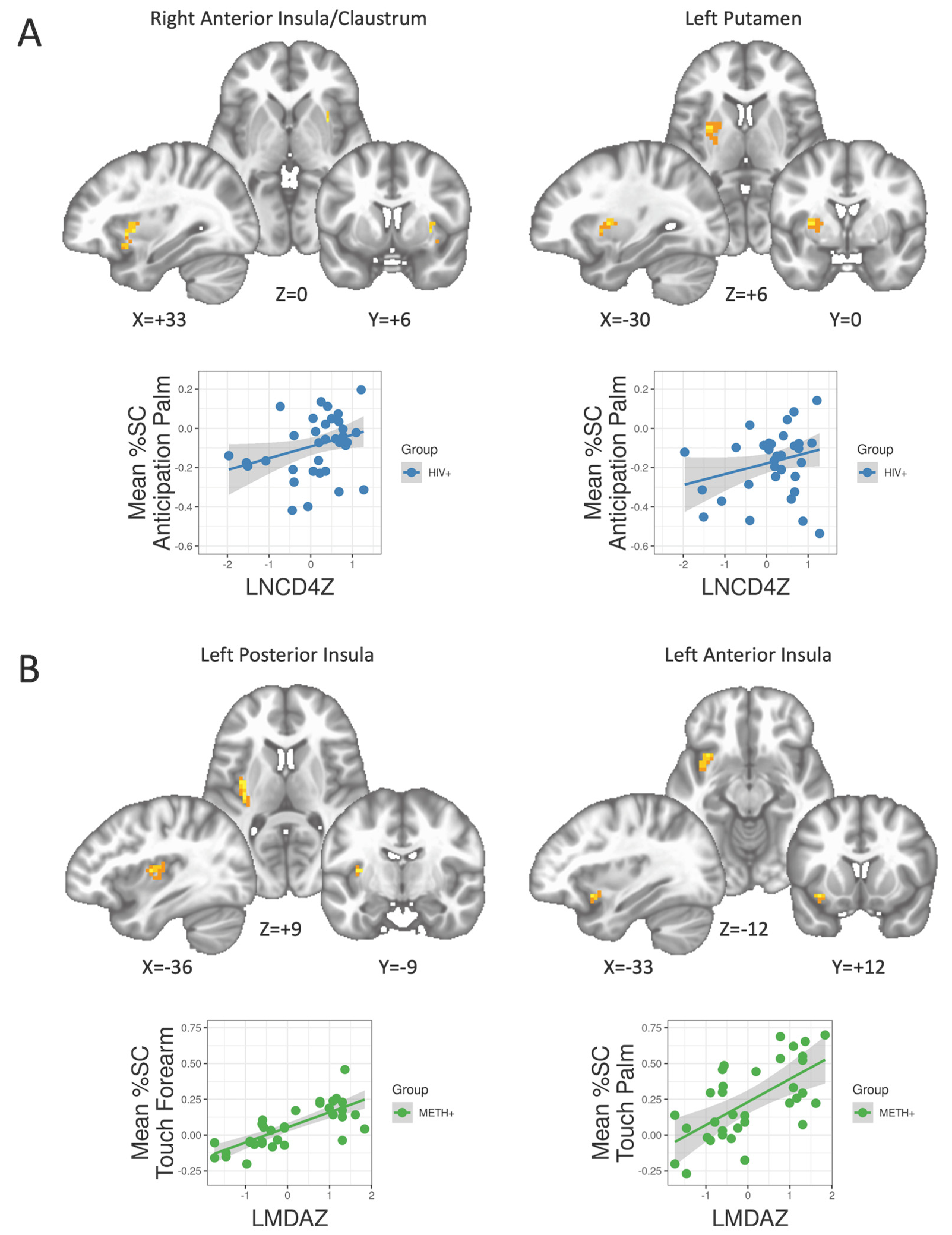 Viruses Free Full-Text Prior Methamphetamine Use Disorder History Does Not Impair Interoceptive Processing of Soft Touch in HIV Infection photo