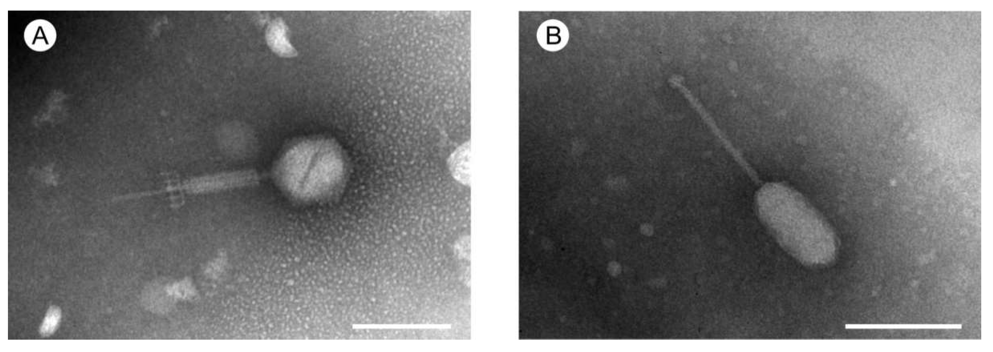 Enterococcus faecalis у мужчин в посеве спермы фото 93