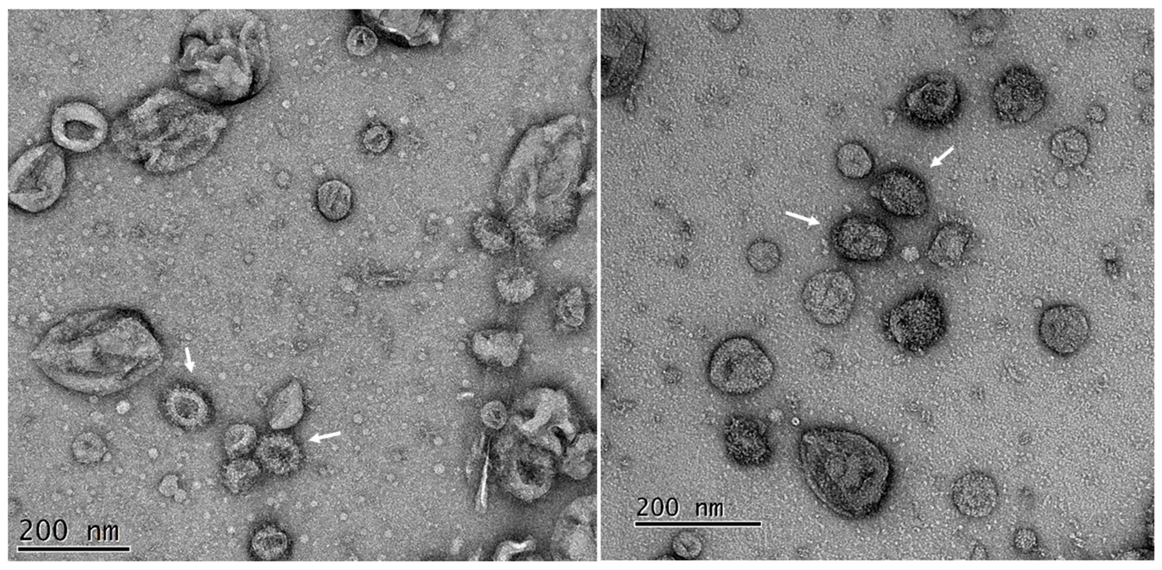 Viruses 14 00914 g004 Viruses 14 00914 g004