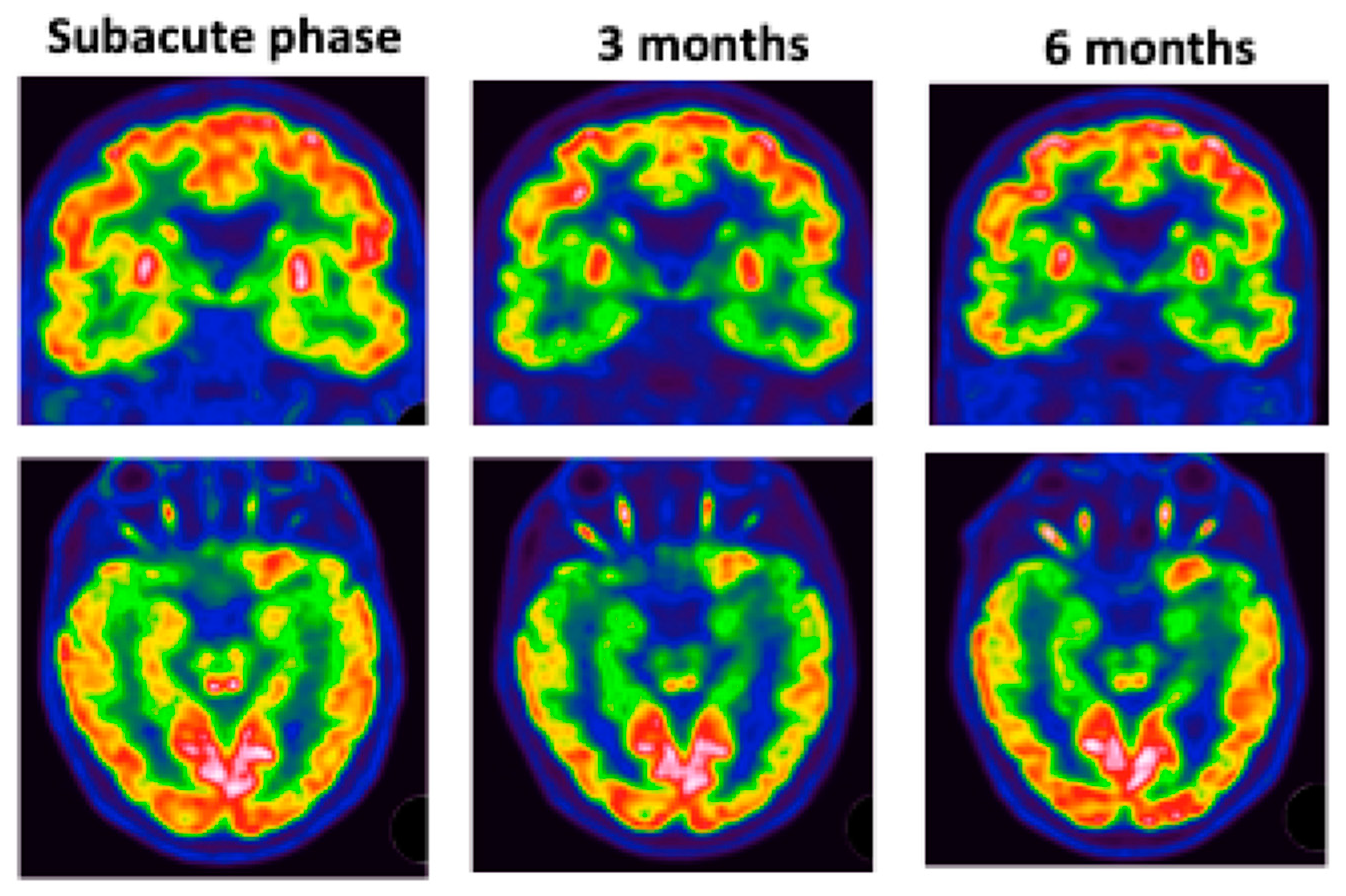 Viruses 14 00949 g005