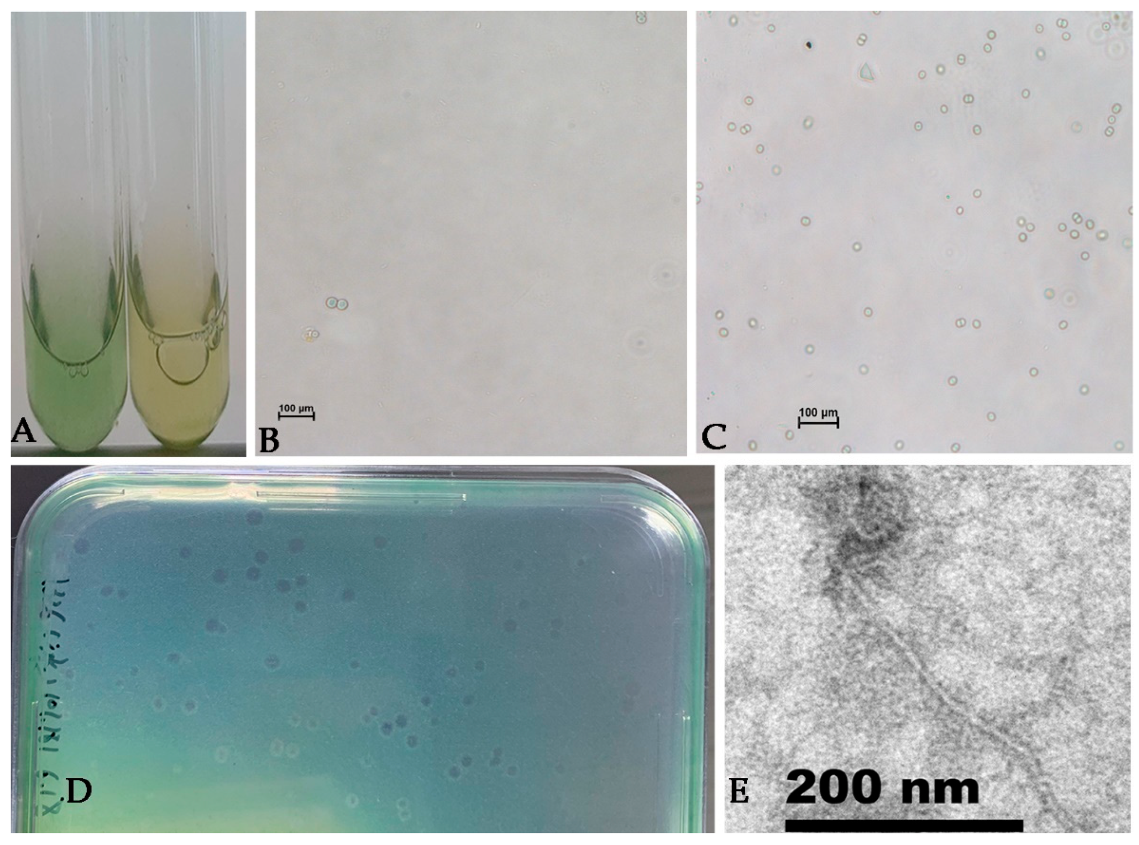 Viruses | Free Full-Text | A Novel Freshwater Cyanophage Mae-Yong1326-1  Infecting Bloom-Forming Cyanobacterium Microcystis aeruginosa