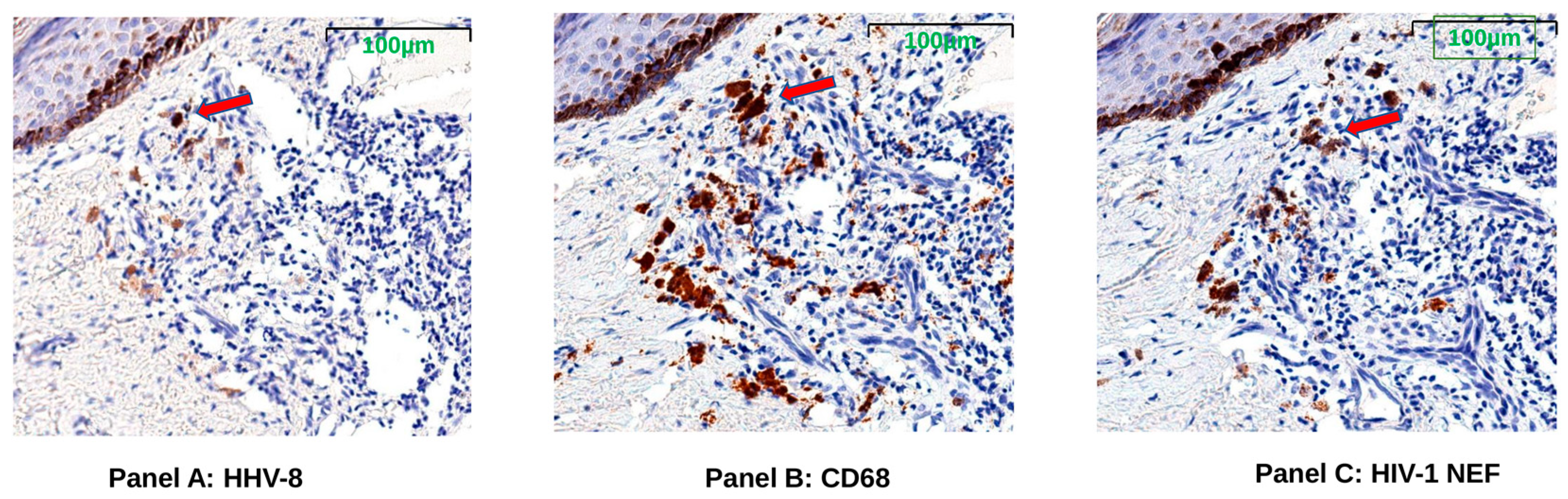 Viruses 14 02774 g003 Viruses 14 02774 g003