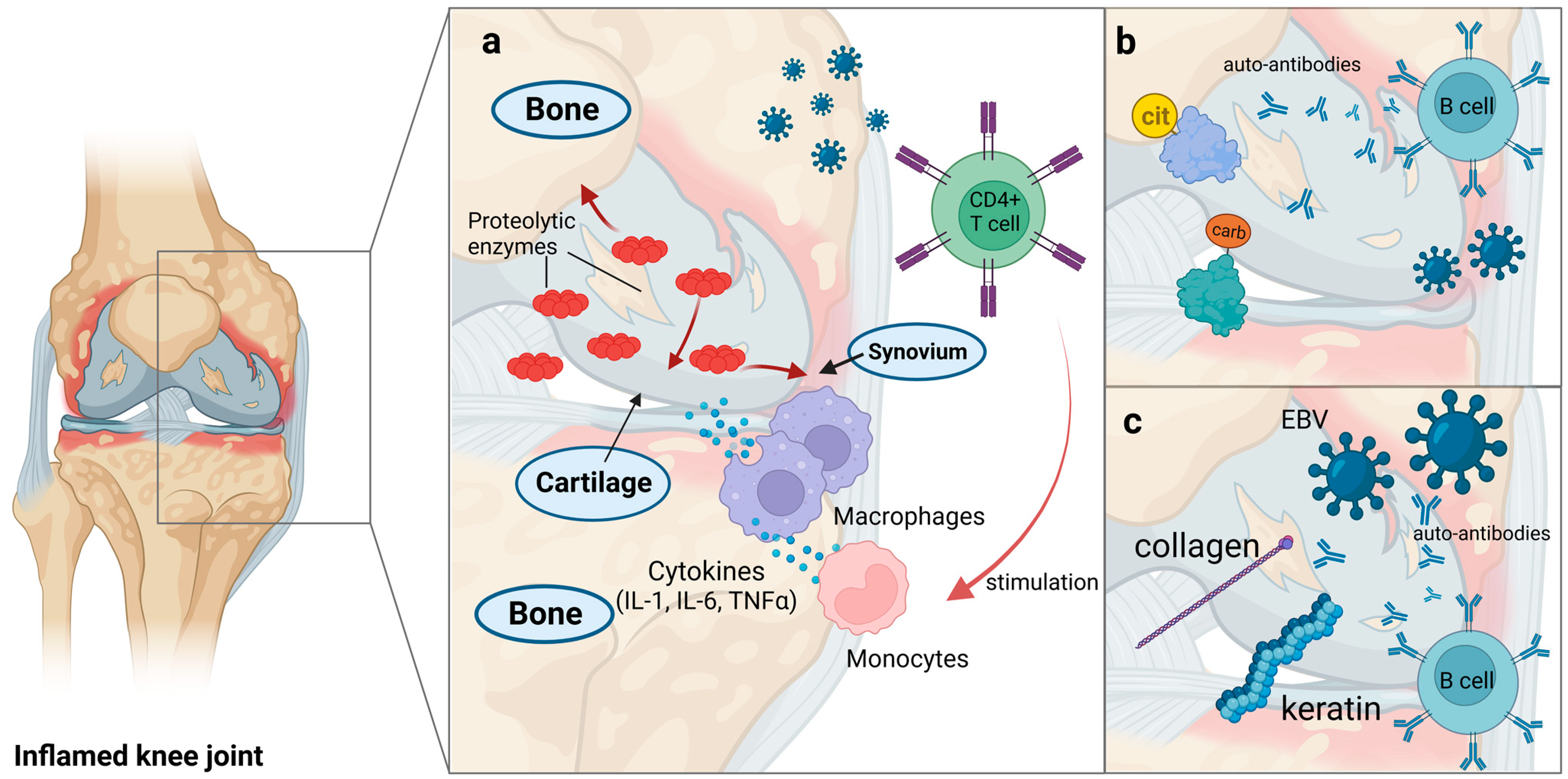 Viruses | Free Full-Text | The Role of Viral Infections in the 