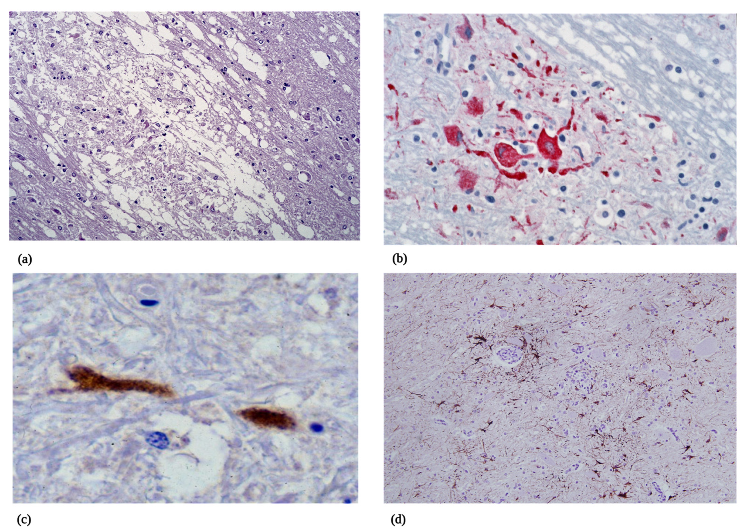 Viruses 15 01230 g003 Viruses 15 01230 g003