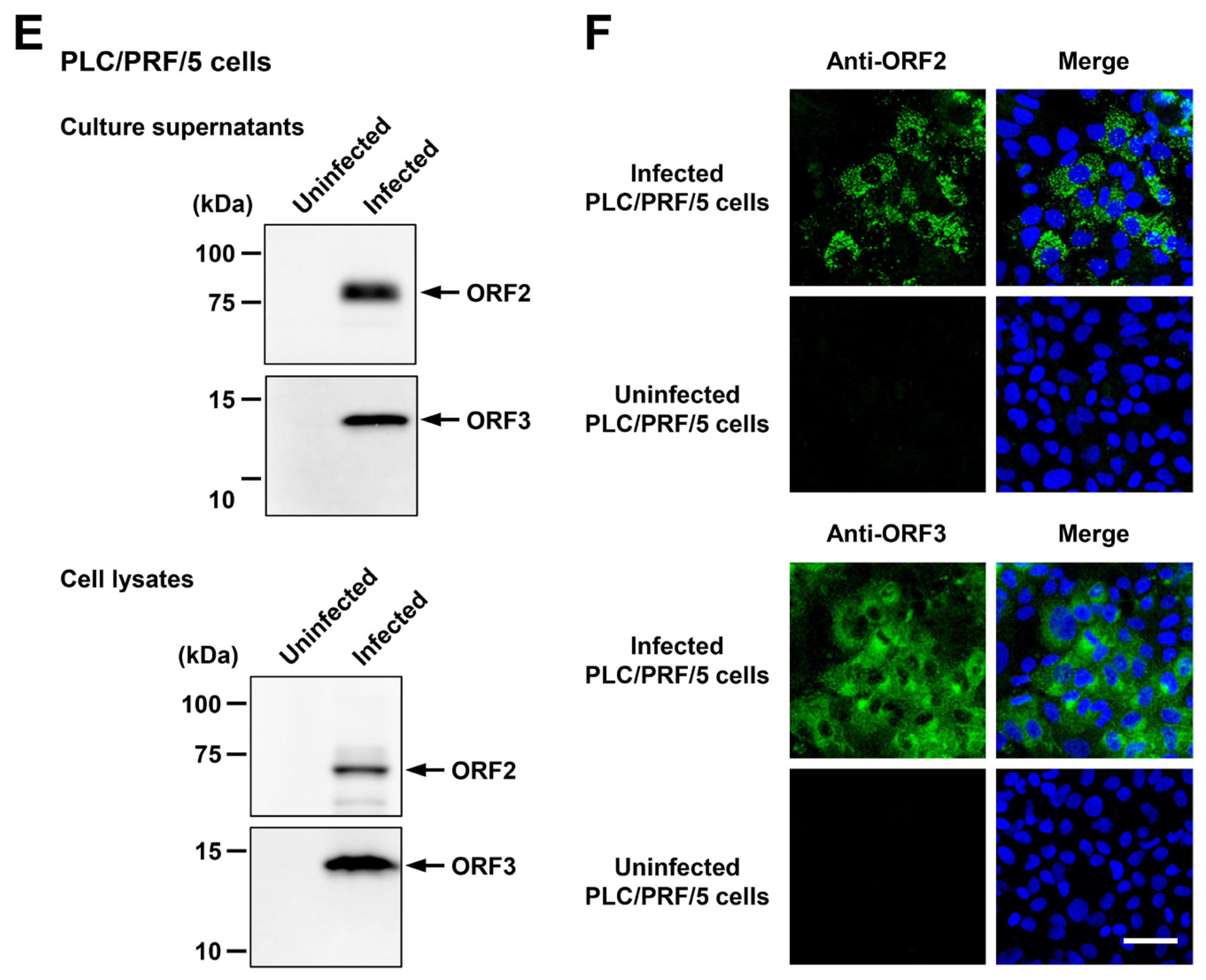 Viruses 16 00842 g005b