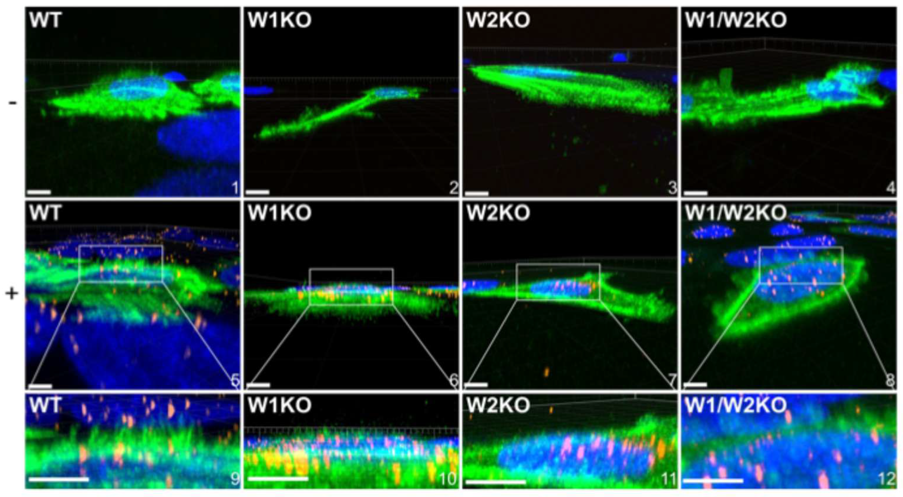Viruses 17 00542 g007