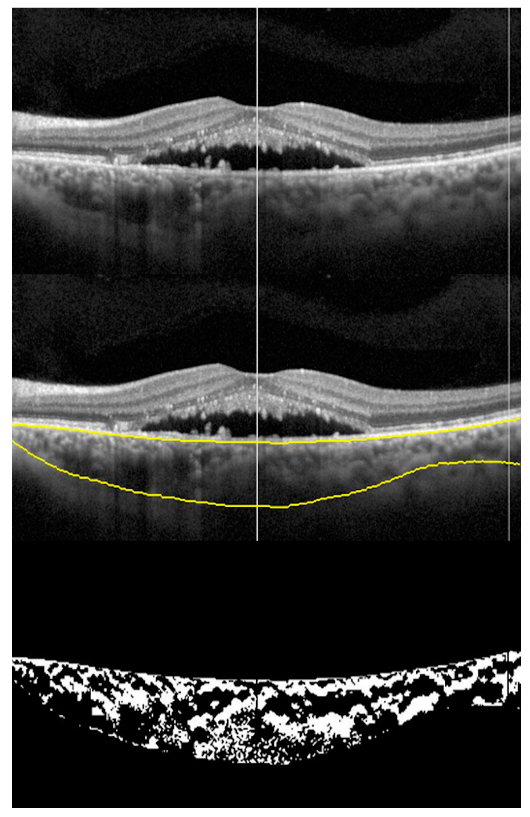 Vision 04 00044 g002 Vision 04 00044 g002