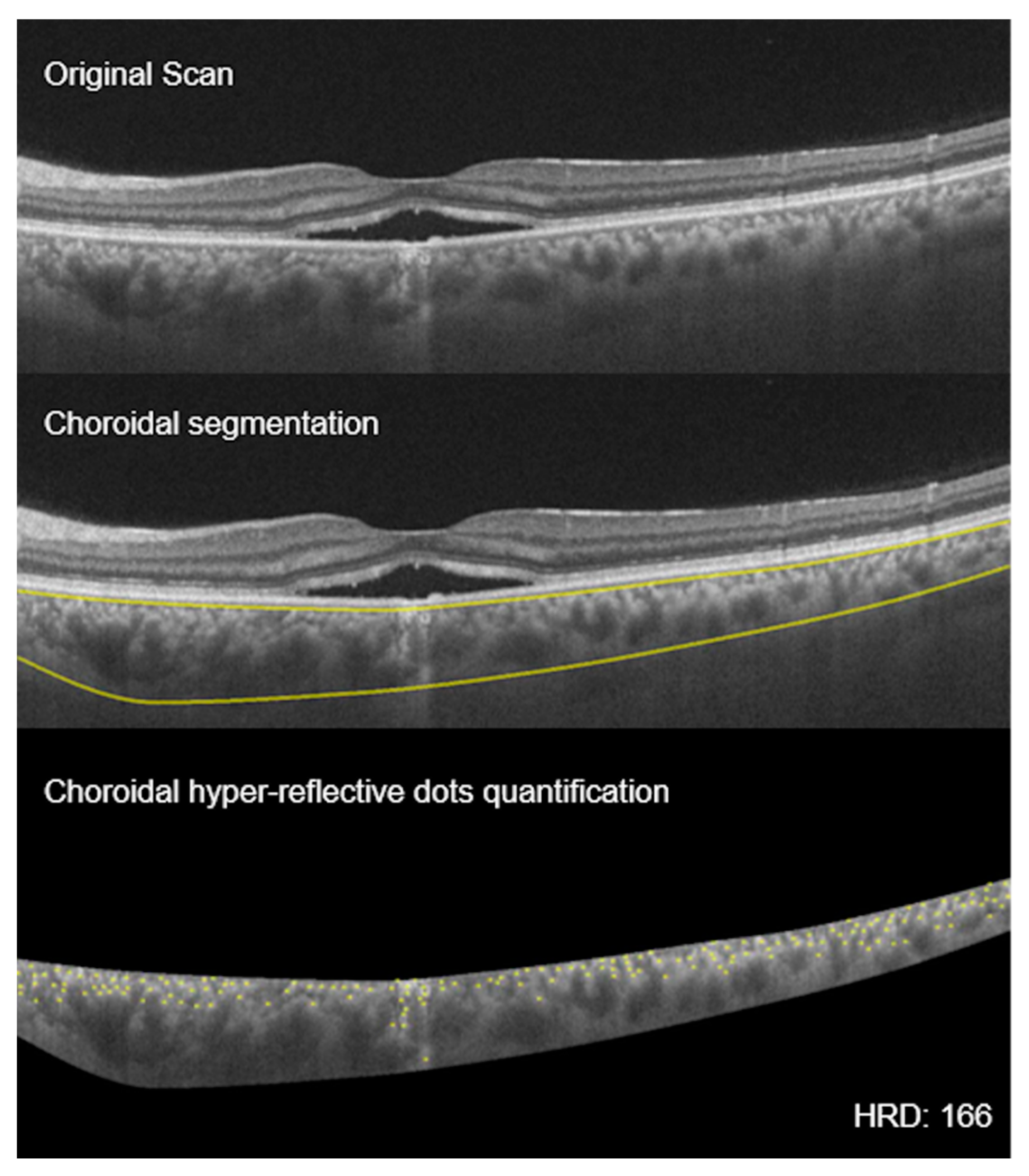 Vision 04 00044 g006 Vision 04 00044 g006