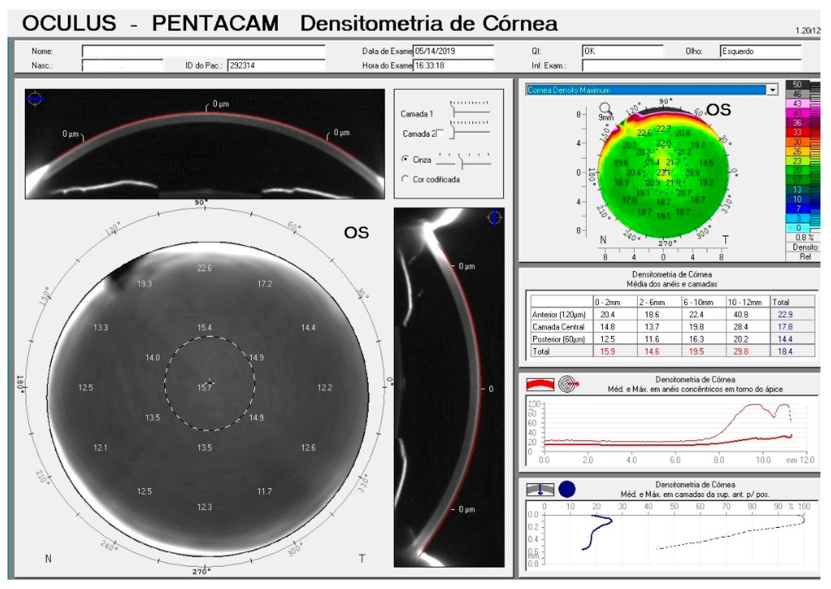 Vision 04 00045 g001 Vision 04 00045 g001