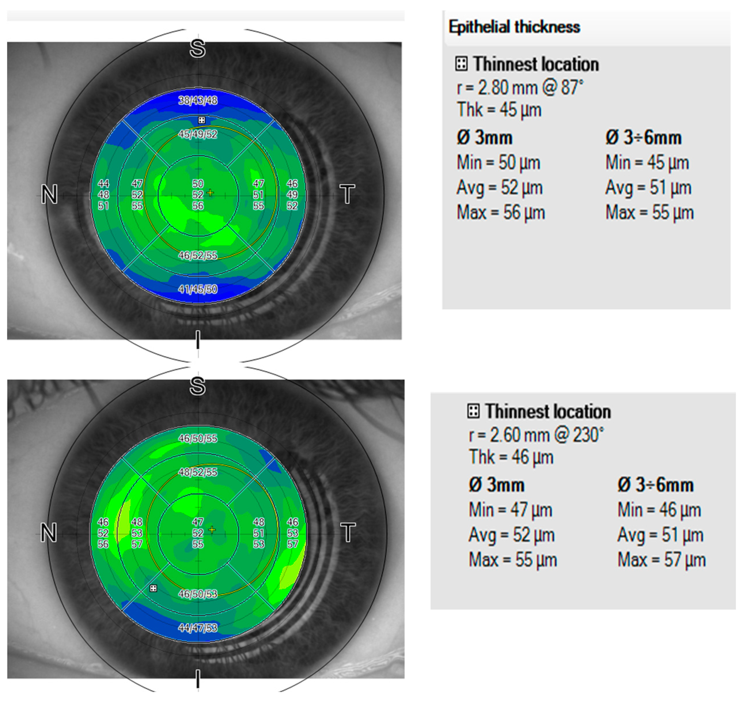 Vision 06 00074 g006 Vision 06 00074 g006