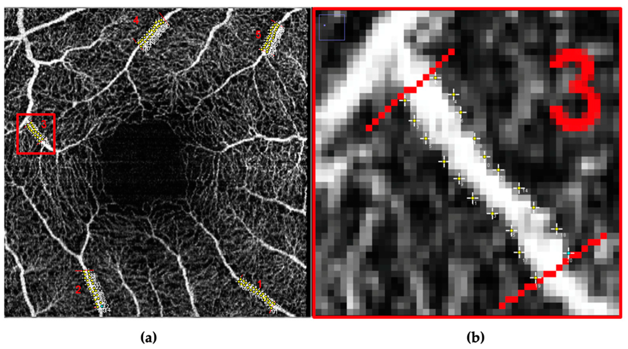 Vision 07 00048 g003
