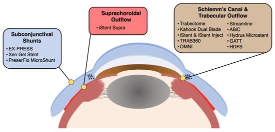 Cureus  Ocular Complications in Patients on Highly Active