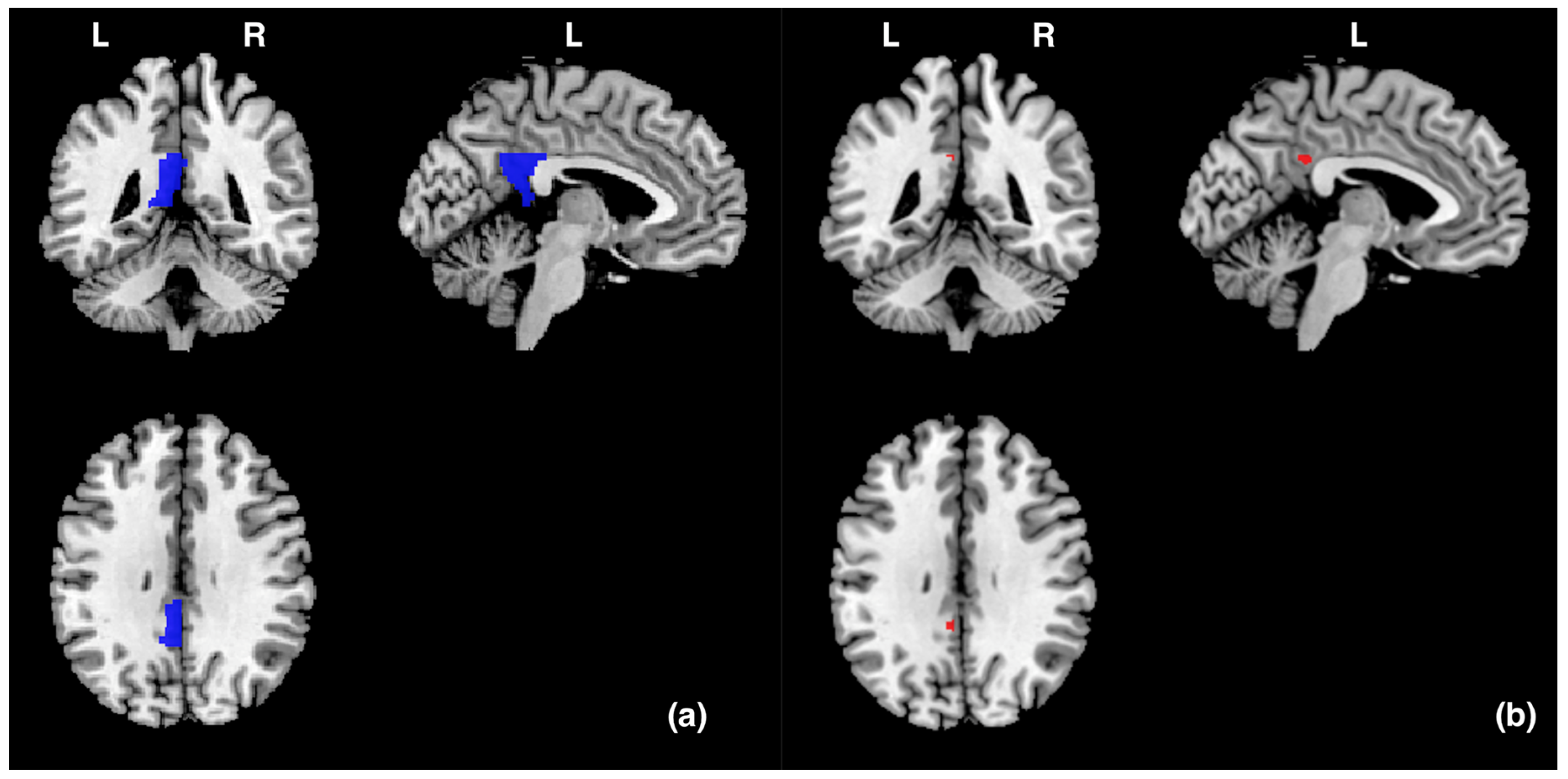 Vision 08 00018 g002 Vision 08 00018 g002