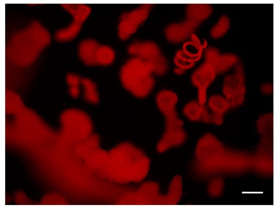 Water Free Full Text Effects Of Harmful Blooms Of Large Sized And Colonial Cyanobacteria On Aquatic Food Webs Html