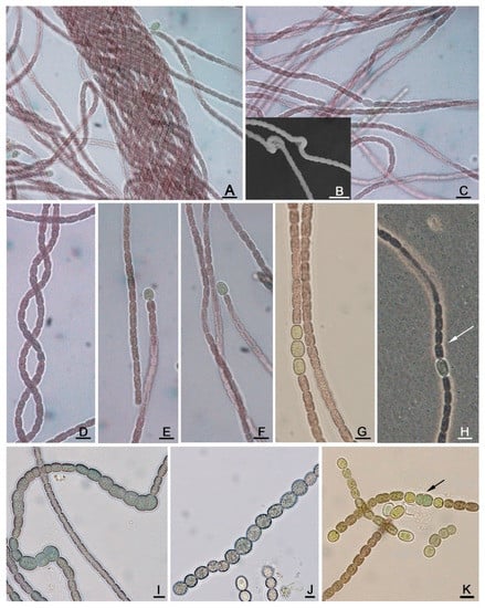 Image: India Ink Stain (Cryptococcus neoformans) - Merck Manuals  Professional Edition